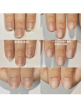 ニコプラス(NICO+)/自爪育成中