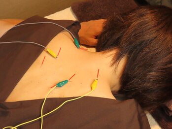 リ フリー 麻生店(Re'free)/はり通電