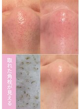 モエラビューティーサロン(Moela beauty salon) 圧巻の 仕上がり！