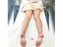 イリス(Iris)の雰囲気（体重は関係ない！ハイパーナイフで引き締めて健康見えが勝ち◎）