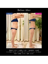 クロシェット(Clochette)/