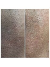 アットユウ(@yu)/フェムエステ