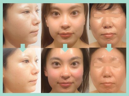 グレースフィオーレ 南越谷店(gracefiore)の写真