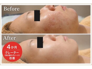 シン(Shin)の写真/【肌質改善が得意なエステサロン】しみ・しわ・たるみが気になる方へ今こそ始める大人のための本格肌質ケア
