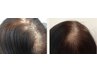 髪にボリューム「ヘアアディクト」15,000円→初回12000円（13,200円税込）