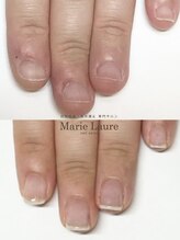マリーロール 梅田店(Marie Laure)/自爪育成/深爪矯正/ネイルケア