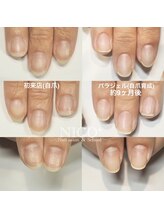 ニコプラス(NICO+)/自爪育成中