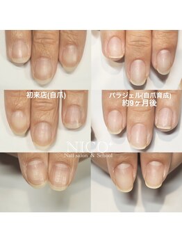 ニコプラス(NICO+)/自爪育成中