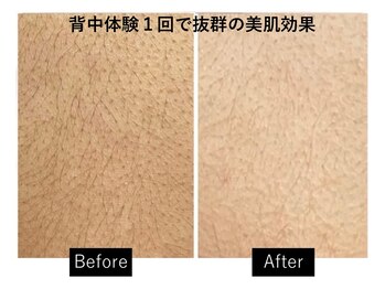 ナチュラーレ 梅田店(Naturale)/美肌ニキビケア小顔フェイシャル