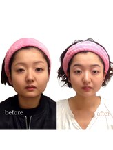 小顔美肌コルギ専門店 センティード 吉祥寺(Sentido)/