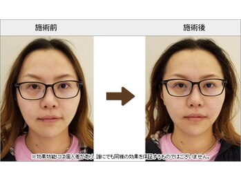 アキュモ整体ラボ/吉祥寺の小顔矯正専門店