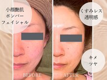 セルベッラ(cerbella)の雰囲気（キメも整い最高な艶肌に！！）