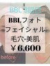 【美肌作り】これからのシミシワ対策光フェイシャル体験 ¥12,000→¥6,600