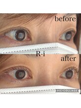 アールアイ(R-i)/アイリッドアップパーマ