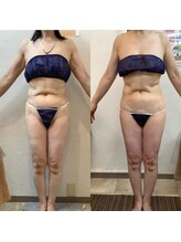 エステ ド モモコ/エンダモロジーアライアンス