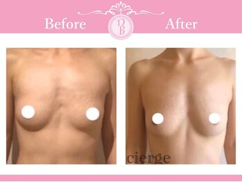 デミーナ(Demyna)/