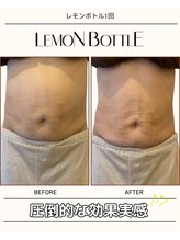 グラシーズ(Glasses)/レモンボトル