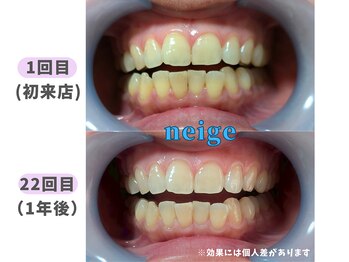 ネージュ(neige)/50代前半/女性/コーヒー1日3杯