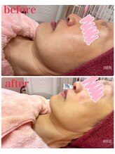 リッチフェイス 京都店(Rich Face)/小顔顔筋形成