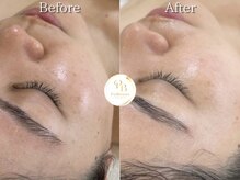 プリュボーテ(Pul Beaute)/白く輝く肌を手に入れたい