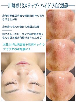 マヒナ(Mahina)の写真/【毛穴の黒ずみ/詰まり/角栓改善】肌質改善×圧倒的結果重視◆水素毛穴洗浄で毛穴レスの韓国艶肌へ!!