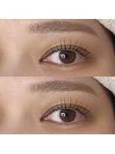 ケーオーエス ピンク(K O S Pink)/人気セットメニュー