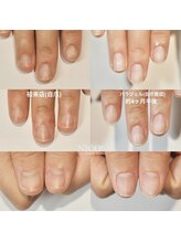 ニコプラス(NICO+)/自爪育成中