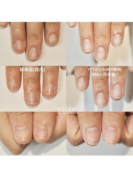 ニコプラス(NICO+)/自爪育成中