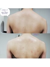 RiとBiのたまご/上半身のマッサージ3回目