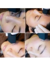 リゲル ザ ベスト(RIGEL the best)/プラズマエ|クソソーム|エステ