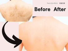 ミネルバエンダモロジー/エンダモロジー/痩身/ウェルネス