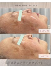 ベルーチェ(BELUCE)/タラソパックでミネラル補給