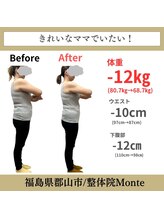 整体院 モンテ(monte)/before＆after