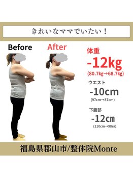 整体院 モンテ(monte)/before＆after