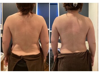 パルタージュ(Partage)/アロマリンパマッサージ