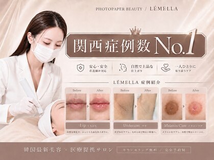 エルビービュティーサロン(LB BEAUTY SALON)の写真