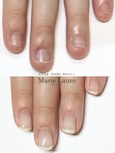 マリーロール 梅田店(Marie Laure)/自爪育成/深爪矯正/ネイルケア
