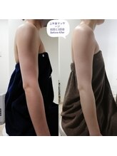 RiとBiのたまご/上半身のマッサージ3回目