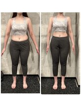 ミスプロ(M'spro)/2ヶ月間ビフォーアフター1