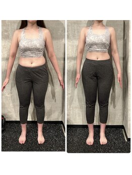 ミスプロ(M'spro)/2ヶ月間ビフォーアフター1