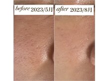 ミュー(myu)の雰囲気（変化の積み重ねで、なめらかなお肌に）