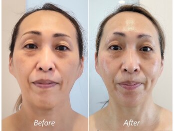 ドクターボディ 新宿店(Dr.Body)/【たるみ/左右差/歪み 50代】