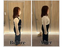 整体ラルース 中目黒(LALUZ)/20代 女性 猫背、巻き肩改善