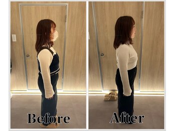 整体ラルース 中目黒(LALUZ)/20代 女性 猫背、巻き肩改善
