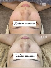 ムム(mumu)/透明感upワンランク上のお肌へ