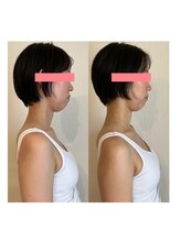 カラダミックス(karadamix)/ストレートネック、巻き型改善