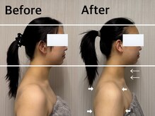 ベール(BEHL)/コルギのBefore After