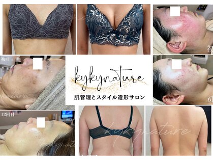 キュキュナチュレの写真