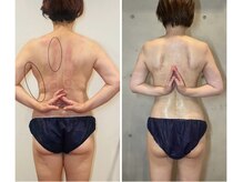 ロータス(Lotus)の雰囲気（結果出しにこだわります。ブライダルやイベント前にラジオ波/EMS）