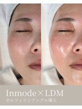 エムネ ラボ 大阪本町(M/NE &nbsp;LAB)/インモード×LDM　